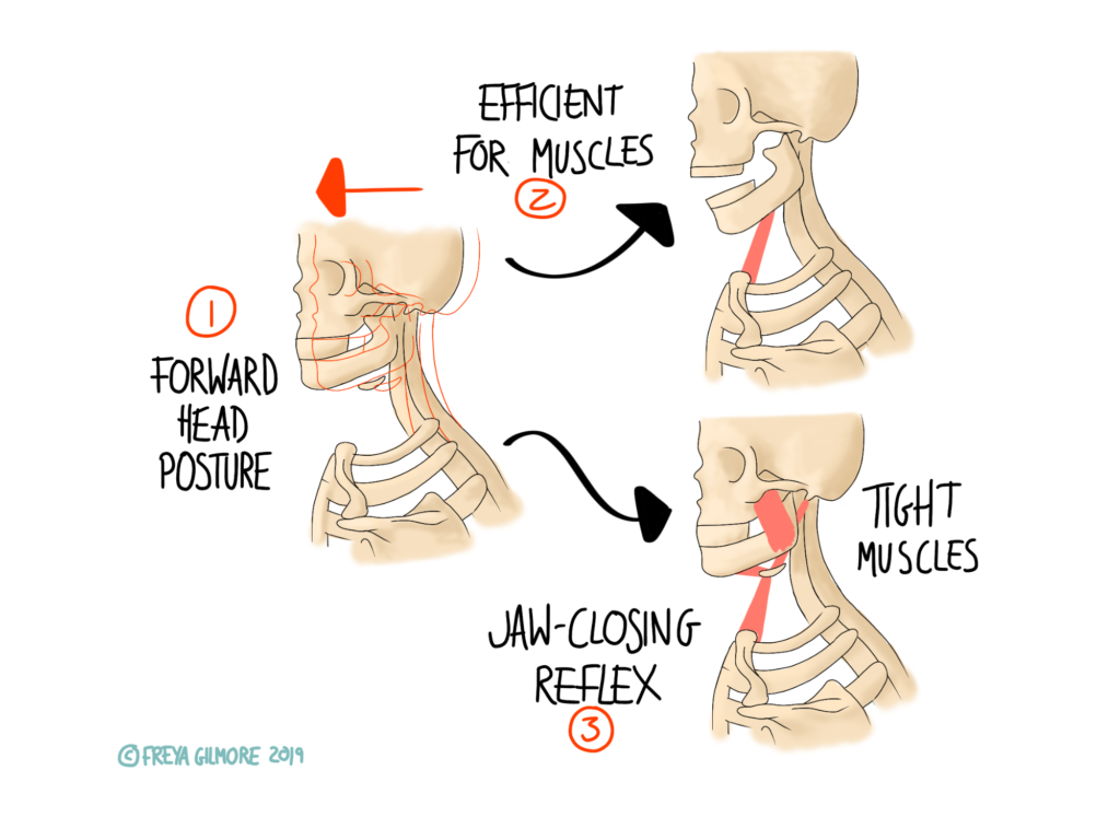 Neck pain and posture